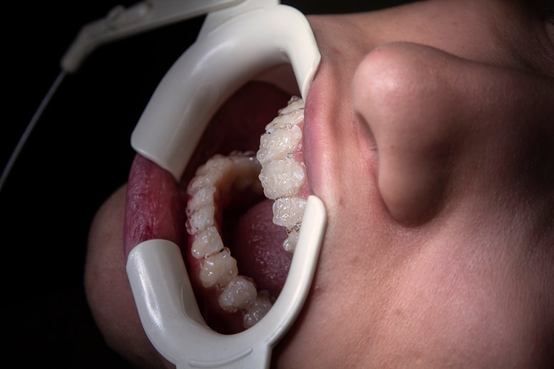 a close up of a person's mouth with a dental device attached to it